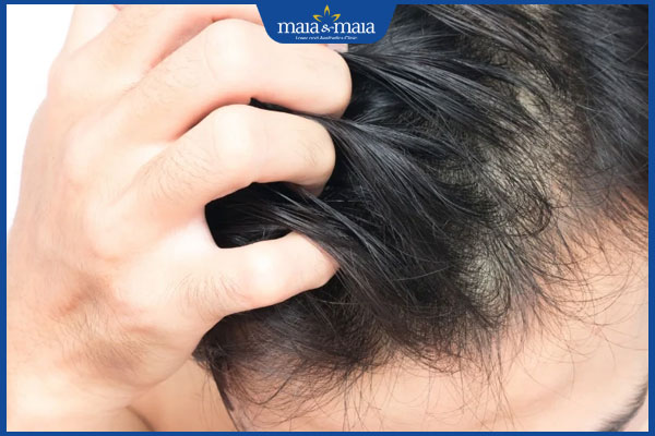ngứa tại vết tiêm