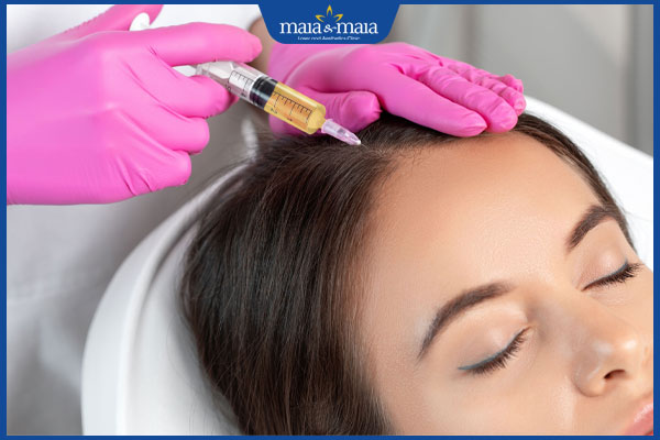tiêm prp trị rụng tóc