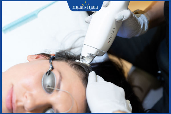 dùng laser trị rụng tóc