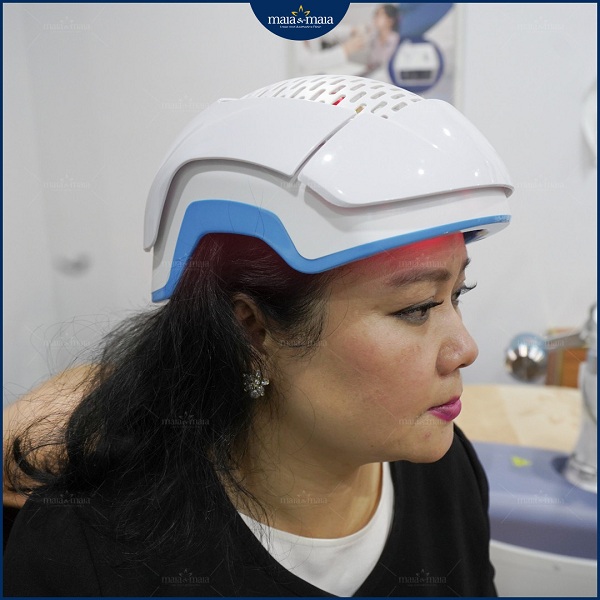 Giải pháp cho chứng rụng tóc do mãn kinh ở phụ nữ 4 Công nghệ Meso hỗ trợ điều trị rụng tóc tại phòng khám Maia&Maia