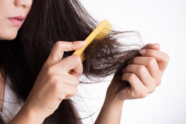 Điều trị rụng tóc bằng Rogaine có hiệu quả không? 4 Điều trị rụng tóc bằng Rogaine có thể khiến tóc rụng nhiều hơn trong những tuần đầu