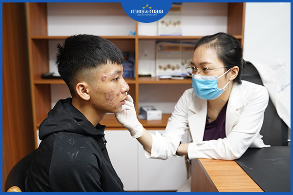 Mụn nang là gì? Những cách điều trị mụn nang 5 Bạn nên thăm khám với bác sĩ da liễu để được kê đơn thuốc phù hợp
