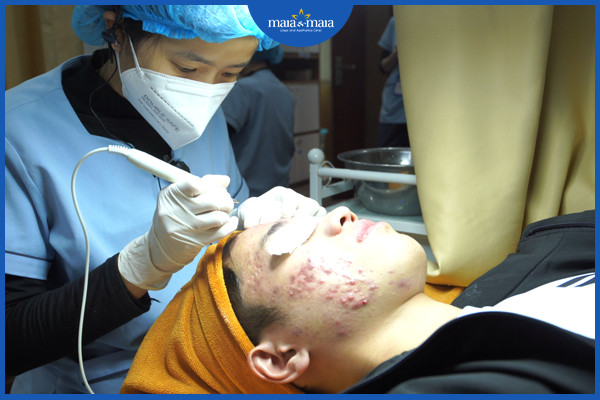 Mụn vùng cổ và phương pháp điều trị 5 Loại bỏ nhân mụn bằng công nghệ cao tại phòng khám Maia