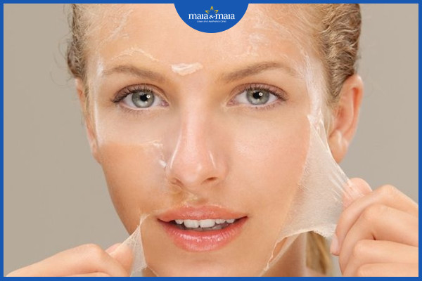 So sánh hai phương pháp thẩm mỹ: Peel da và tái tạo bề mặt da bằng laser 2 Lột da hóa chất là phương pháp thẩm mỹ cần được thực hiện bởi bác sĩ da liễu