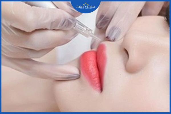 Những điều cần biết khi xóa xăm 3 Xăm môi thẩm mỹ