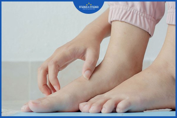Viêm da dị ứng ở tay chân 4 viêm da