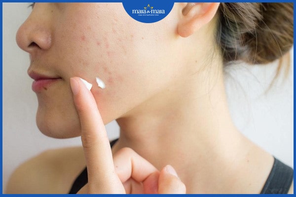 Bệnh viêm nang lông ở mặt có thực sự nguy hiểm không? 3 bệnh viêm nang lông ở mặt