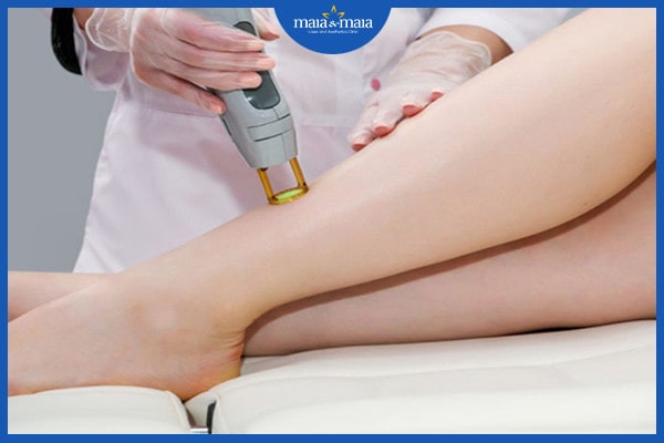 Điều trị bệnh viêm nang lông thế nào? Phương pháp nào hiệu quả nhất? 4 điều trị bệnh viêm nang lông