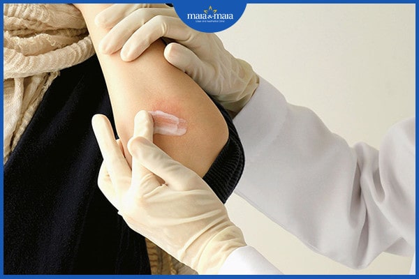 Viêm nang lông bạch cầu ái toan có nguy hiểm không? 4 Viêm nang lông bạch cầu ái toan
