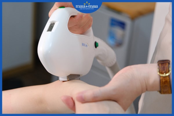 Viêm nang lông là bệnh gì? Nguyên nhân, biểu hiện và cách điều trị 4 Viêm nang lông