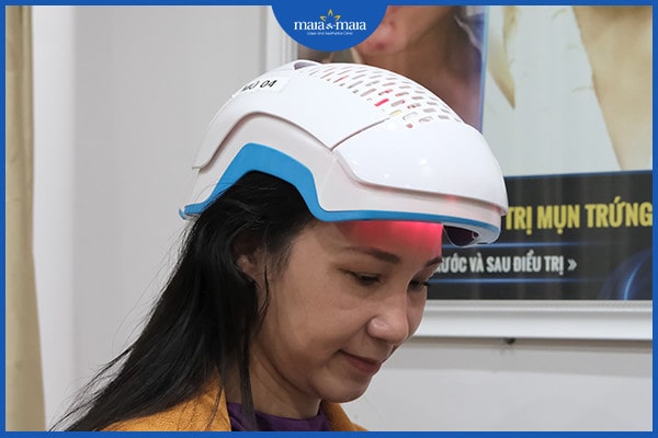 Viêm nang lông da đầu có lây không? Điều trị ở đâu hiệu quả? 3 Viêm nang lông da đầu có lây không