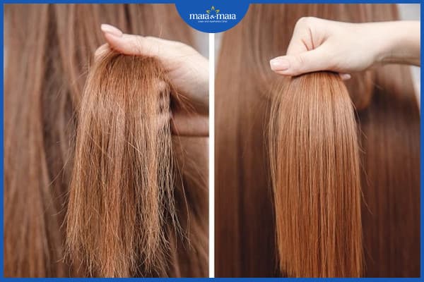 Giải đáp thắc mắc: Gội đầu nhiều có nhanh mọc tóc không? 2 Gội đầu nhiều có nhanh mọc tóc