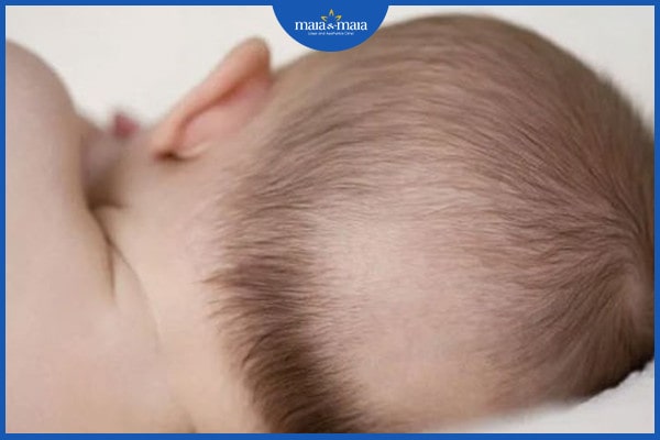 Rụng tóc ở trẻ 3 tháng tuổi có nguy hiểm không? Nguyên nhân là gì? 2 Rụng tóc ở trẻ 3 tháng tuổi