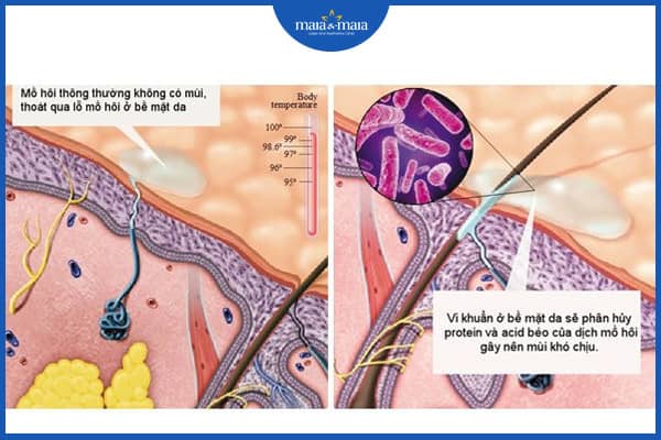 Những thực phẩm gây hôi nách cần tránh để ngăn mùi cơ thể 2 thực phẩm gây hôi nách