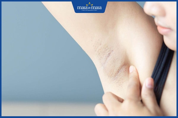 có bầu dùng lăn khử mùi được không