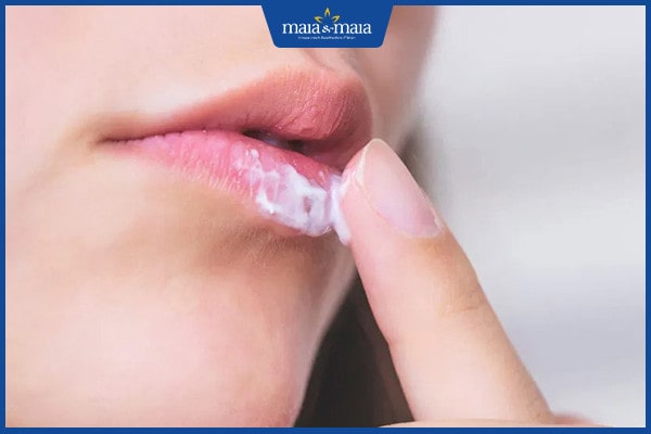 Cách điều trị viêm môi chuẩn y khoa từ bác sĩ da liễu 3 điều trị viêm môi