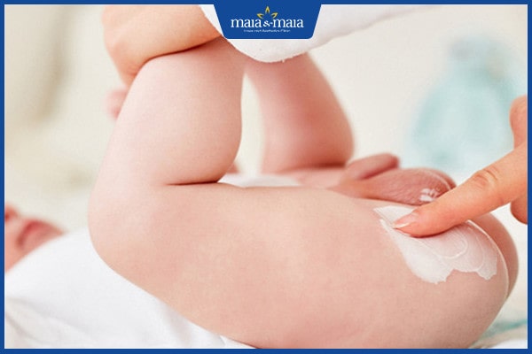 Thế nào là viêm da tã lót? 3 Viêm da tã lót