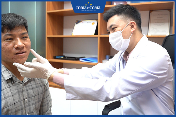 Cách chữa mụn bọc ở má hiệu quả 3 maia&maia
