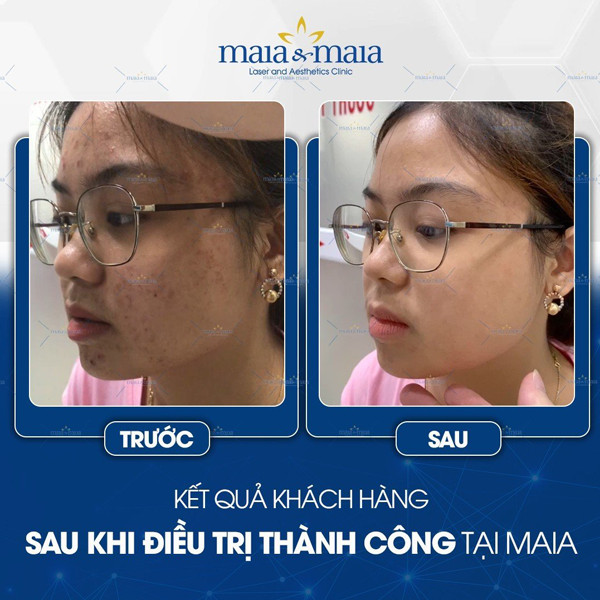 tri mun 12