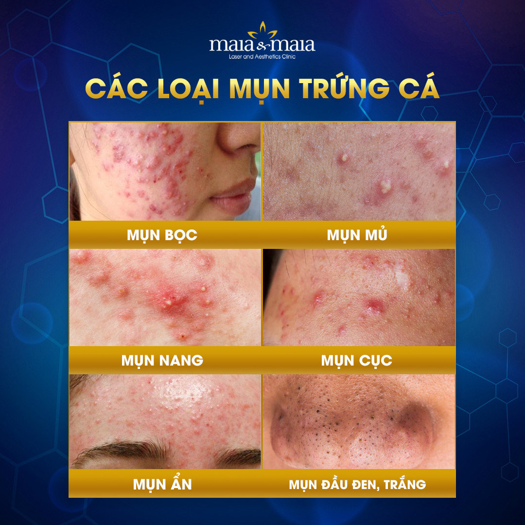 tri mun web 10