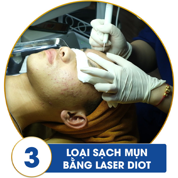 tri mun laser 5