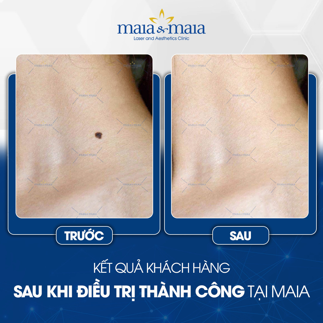 tay not ruoi o ha noi 11