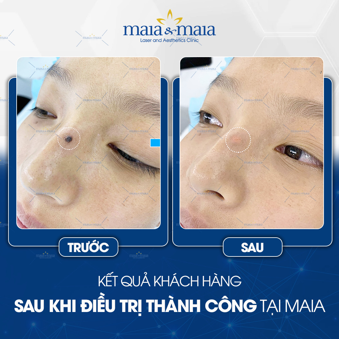 tay not ruoi o ha noi 7