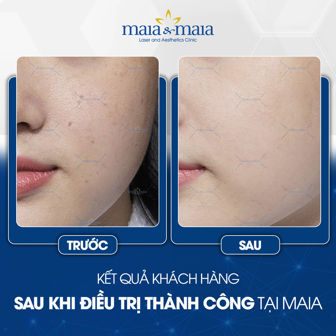tay not ruoi o ha noi 9