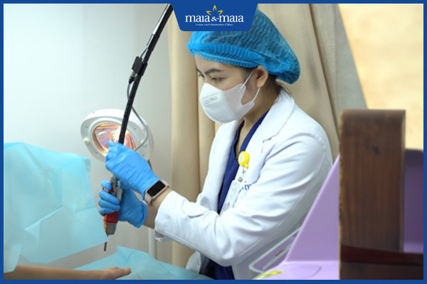 Công nghệ Maitrix Gene điều trị sùi mào gà hiệu quả tới 99% 4 Kết thúc quy trình bác sĩ hướng dẫn thoa thuốc đặc trị phục hồi niêm mạc