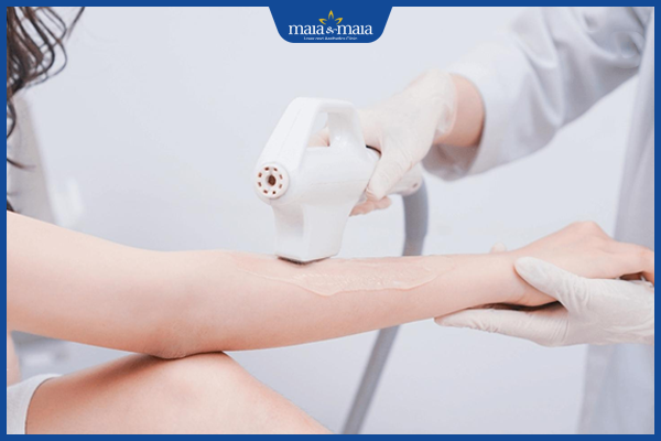 Công nghệ Maitrix DiPL giải pháp triệt lông vĩnh viễn hoàn hảo 5 CÔNG NGHỆ MAITRIX DiPL - GIẢI PHÁP HOÀN HẢO ĐỂ TRIỆT LÔNG VĨNH VIỄN