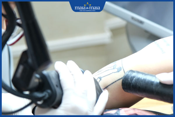 Công nghệ maitrix tattoo