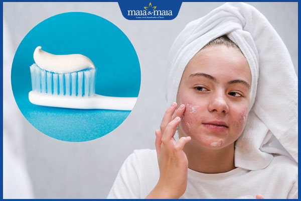chữa mụn trứng cá bằng kem đánh răng
