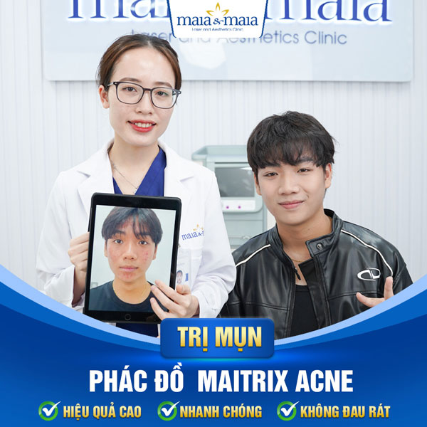 chữa mụn trứng cá thành công