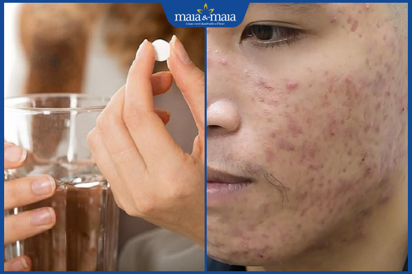 Những sai lầm khi điều trị mụn trứng cá 5 tăng liều lượng thuốc