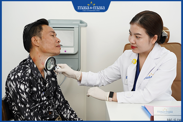 chẩn đoán mụn nước