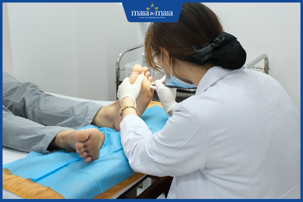 chữa mụn ở chân và ngứa