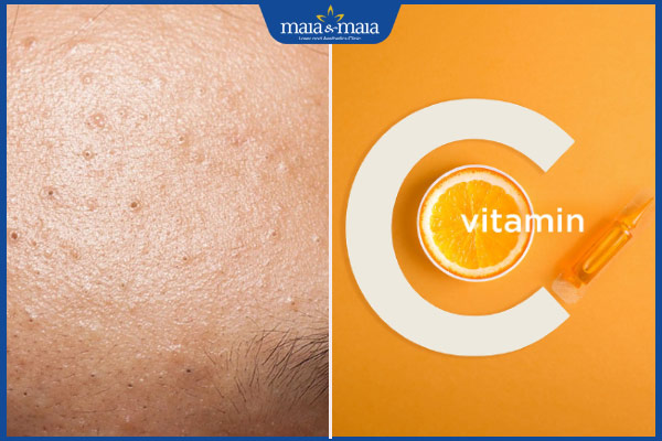 công dụng của vitamin c