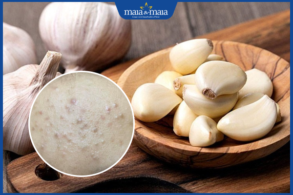 công dụng trị mụn ẩn của tỏi