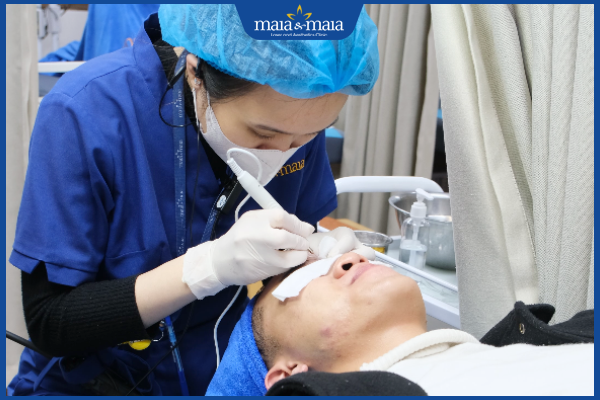 công nghệ trị mụn ẩn
