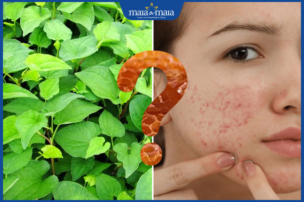 diếp cá trị mụn ẩn hiệu quả không