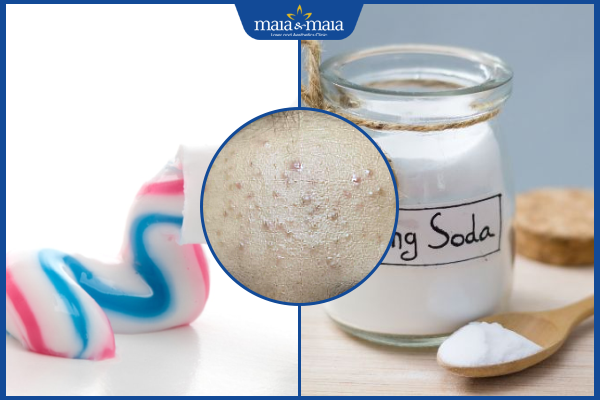kem đánh răng và baking soda