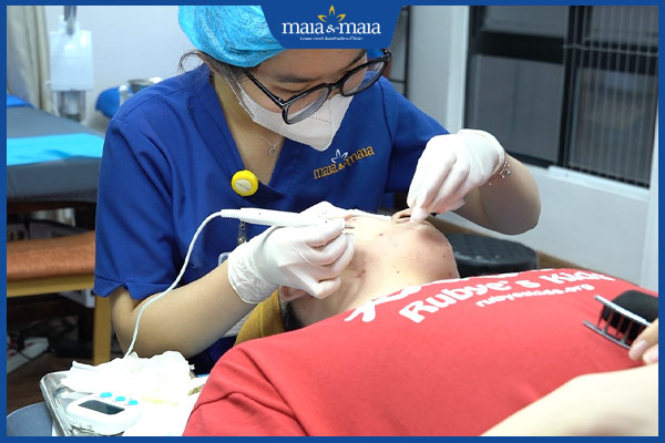 trị mụn đối xứng công nghệ cao