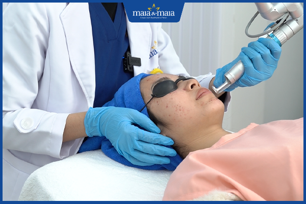 trị mụn trứng cá hiệu quả