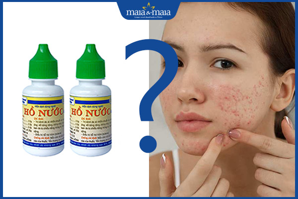 trị trứng cá bằng hồ nước có tốt không