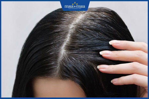 biểu hiện tóc bạc sớm