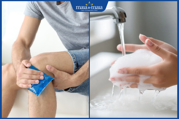 chăm sóc da kiến cắn