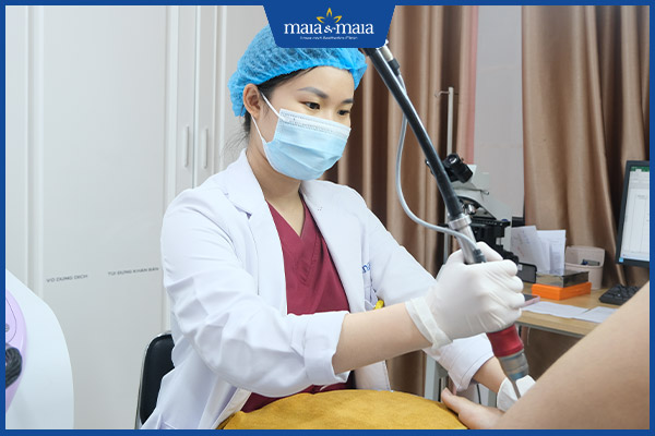 chữa sùi mào gà ở maia