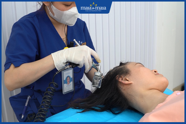 công nghệ cao trị rụng tóc