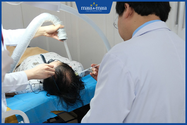 công nghệ điều trị rụng tóc