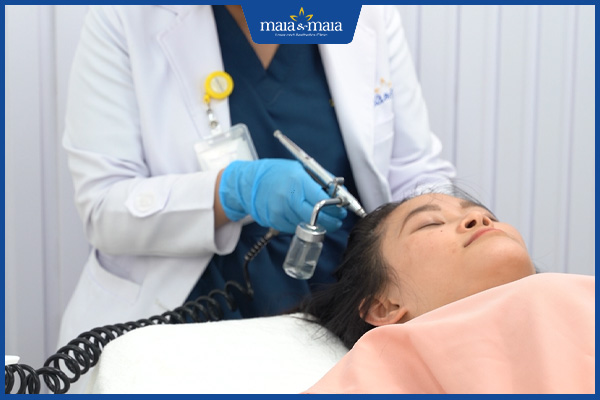 công nghệ trị rụng tóc maia